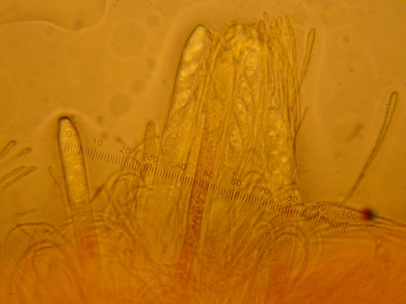 Bisporella  citrina?